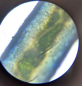 Zdjęcie mikroskopowe w kolorach zielonkawo-niebieskich.
Widoczne są nieregularne struktury — częściowo przezroczyste komórki wypełnione zielonymi drobinkami, które mogą być chloroplastami. W dolnej części obrazu widać cienkie, ciemne włókno lub włosek.
Preparat prawdopodobnie przedstawia fragment liścia z widocznymi komórkami zawierającymi chlorofil.