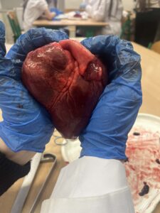 Zbliżenie na serce trzymane w niebieskich rękawiczkach ochronnych – widoczne szczegóły powierzchni i naczyń krwionośnych.